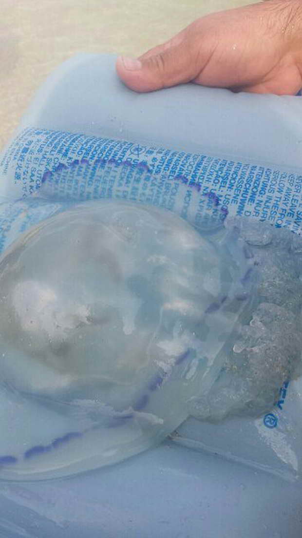 Узбережжя запорізьких курортів "атакують" велетенські чорноморські медузи - фото 3
