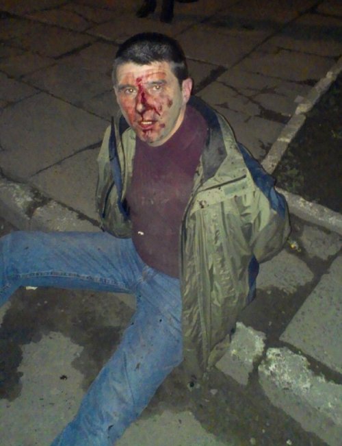 На львівській стоянці чоловік залив кров'ю дорогезні іномарки - фото 2