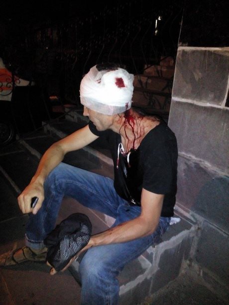 На Київщині "тітушки" побили активіста (ФОТО) - фото 1