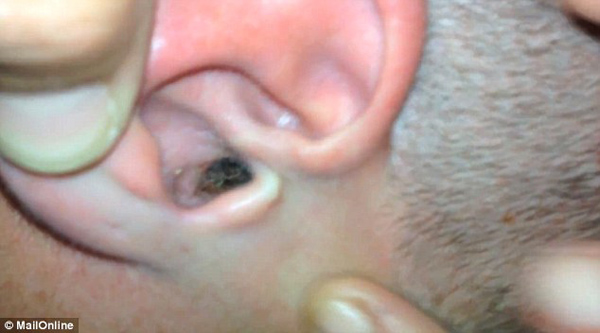 Big Ear Dog Bean Big Ear Dog Bean