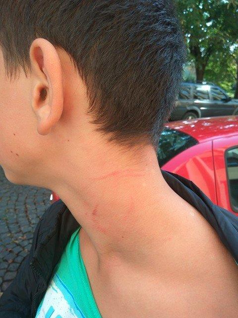 В Ужгороді водій маршрутки вчепився в шию 15-річному хлопцеві - фото 1