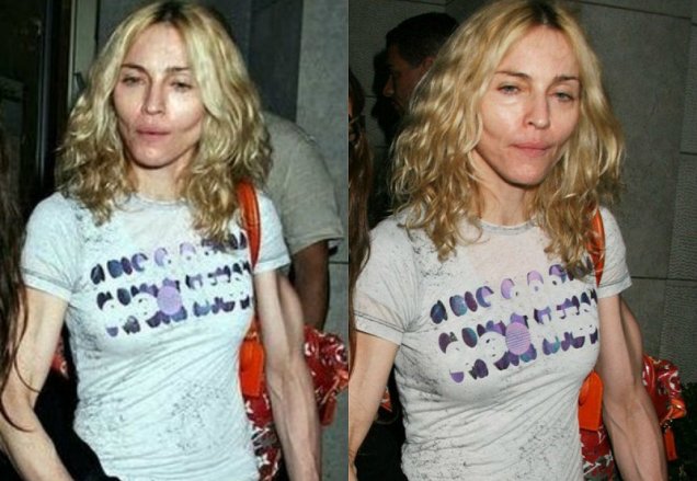 Фото, які зірки ненавидять: Мадонна з ботоксом та груди-втікачі Лоліти - фото 9