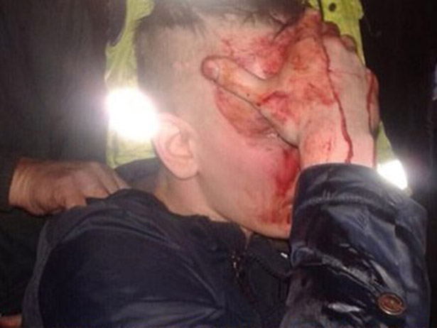 Російські ЗМІ заздалегідь звинуватили ультрас Одеси в побитті росіян в Молдові - фото 1