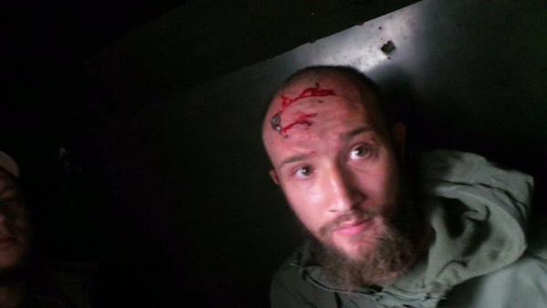 На Харківщині проломили голову активісту, який мітингував під НПЗ, - ЗМІ   - фото 2