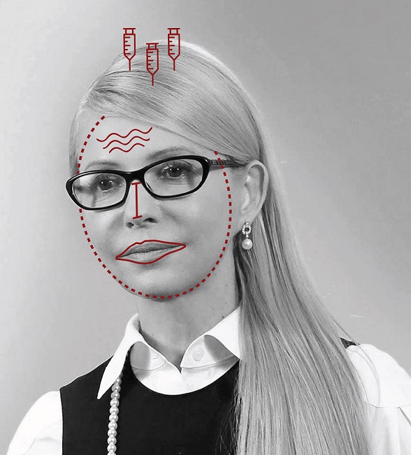 Пластичні хірурги розповіли про секрети краси Тимошенко, дружини Порошенко і Яценюка - фото 1