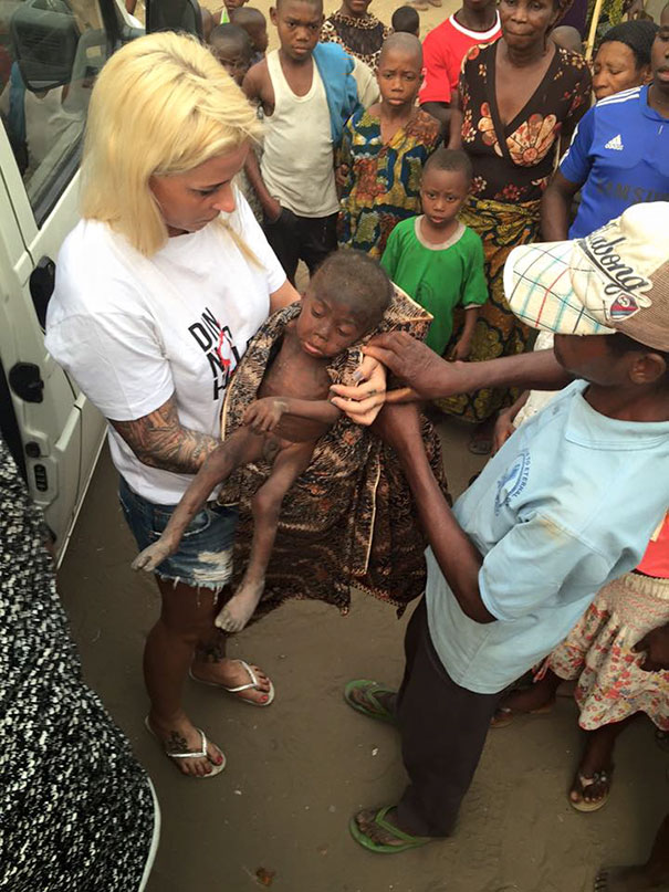 Зворушлива історія про малюка з Нігерії, який помирав від голоду, отримала своє продовження  - фото 2