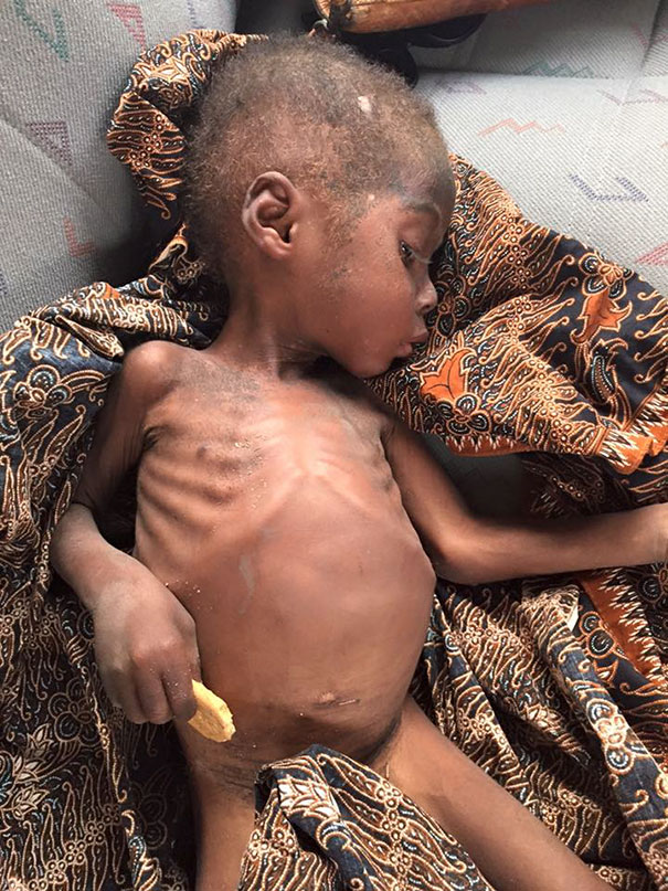 Зворушлива історія про малюка з Нігерії, який помирав від голоду, отримала своє продовження  - фото 3