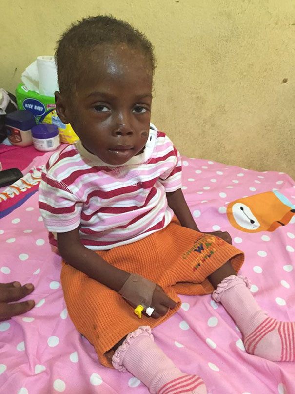 Зворушлива історія про малюка з Нігерії, який помирав від голоду, отримала своє продовження  - фото 7