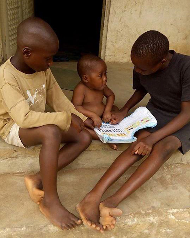 Як змінилося життя нігерійського малюка, який вмирав від дистрофії  - фото 4