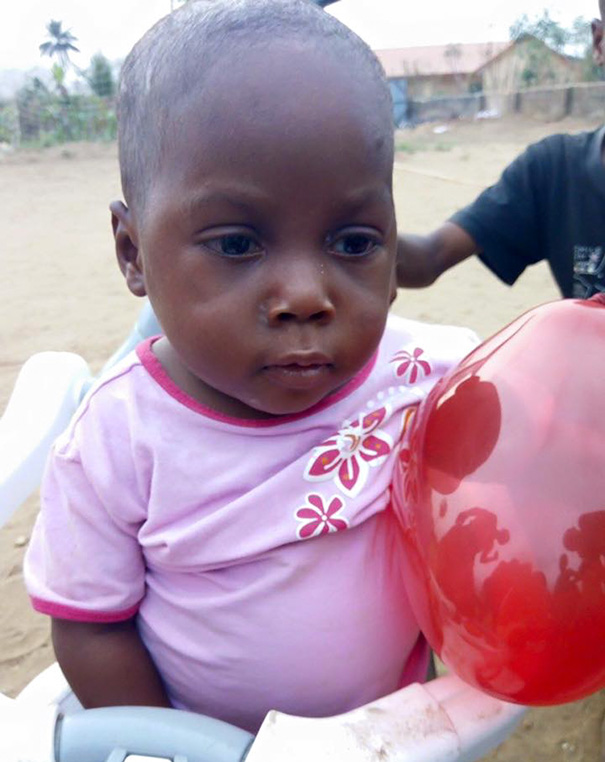 Як змінилося життя нігерійського малюка, який вмирав від дистрофії  - фото 3