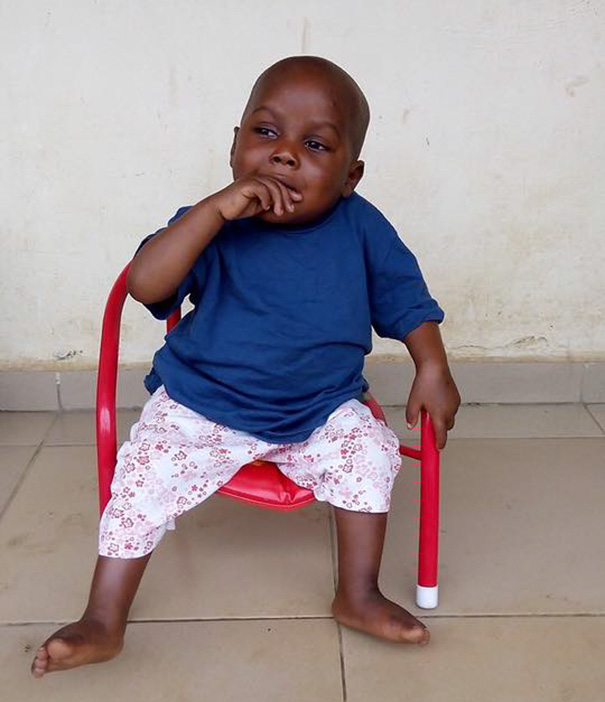 Як змінилося життя нігерійського малюка, який вмирав від дистрофії  - фото 1