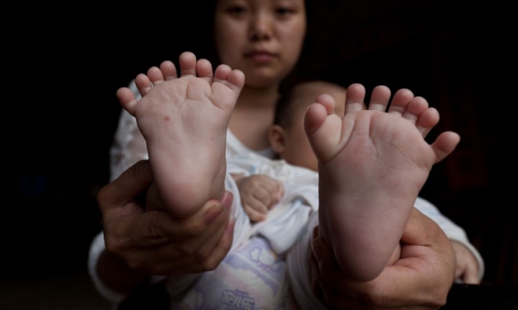 У Китаї народилася дитина з 31 пальцем - фото 2