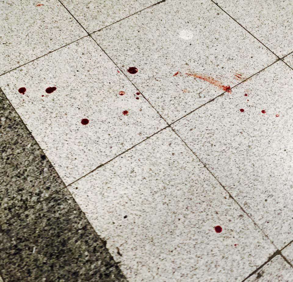 Українець розповів про теракт у Стамбулі, свідком якого він був - фото 3