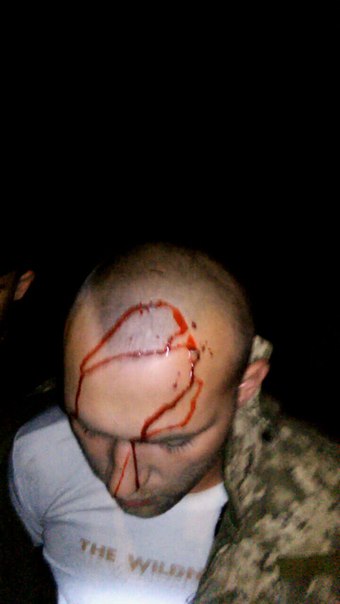 У Миколаєві п'яний водій у військовому розбив головою лобове скло машини - фото 1