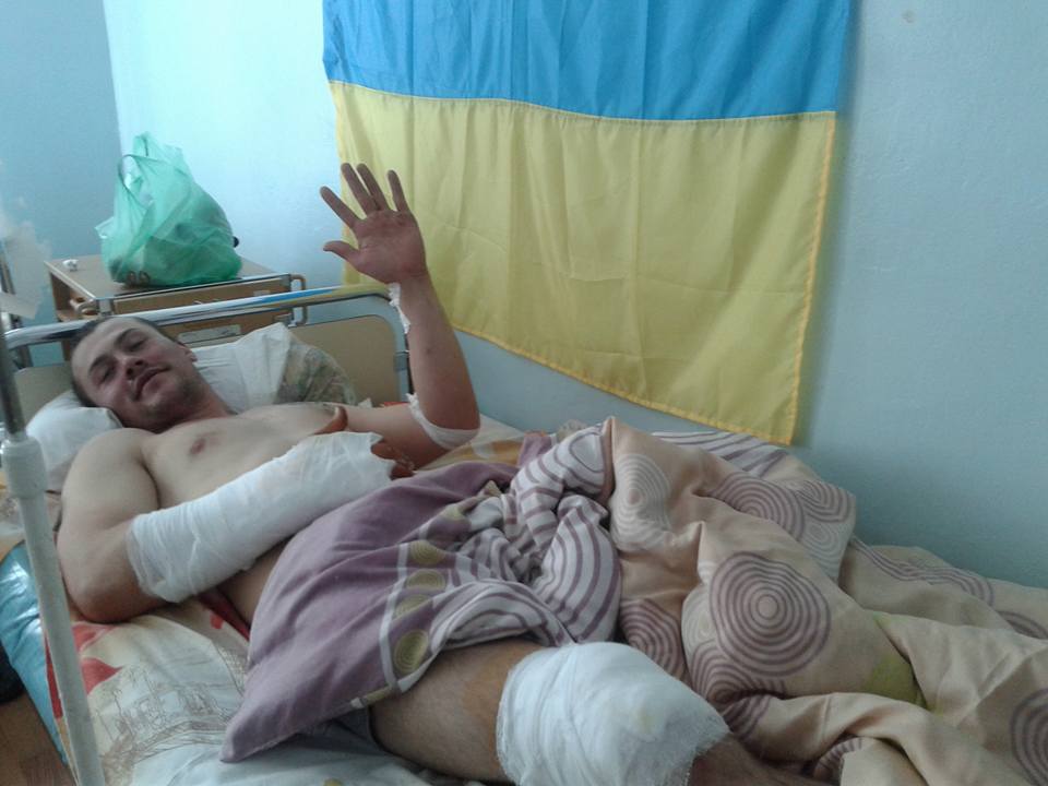 Потужний обстріл позицій ЗСУ під Маріуполем: у шпиталі багато поранених (ФОТО) - фото 4
