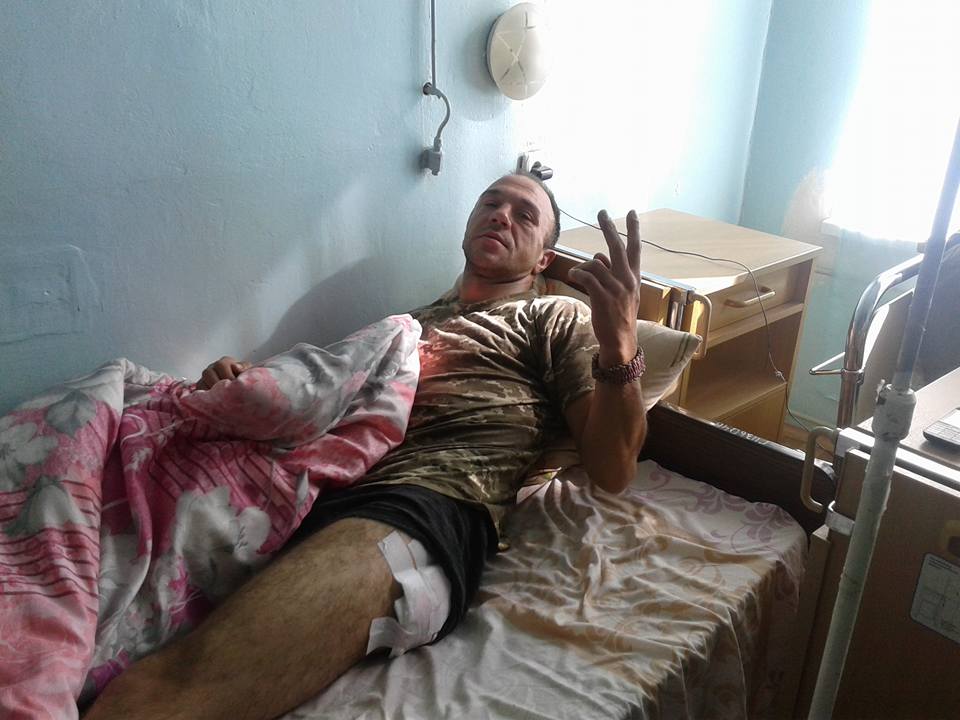Потужний обстріл позицій ЗСУ під Маріуполем: у шпиталі багато поранених (ФОТО) - фото 3