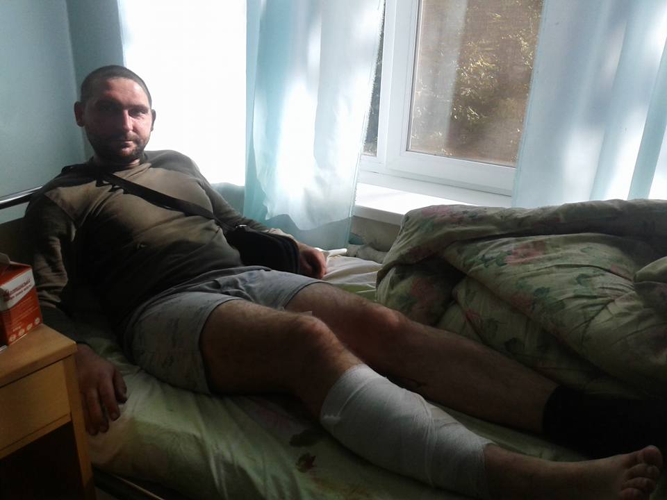 Потужний обстріл позицій ЗСУ під Маріуполем: у шпиталі багато поранених (ФОТО) - фото 1