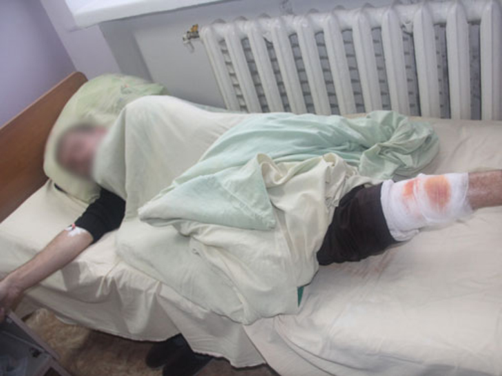 На Чернігівшині в натовпі людей вибухнула граната - фото 3 На Чернігівшині в натовпі людей вибухнула граната - фото 3
