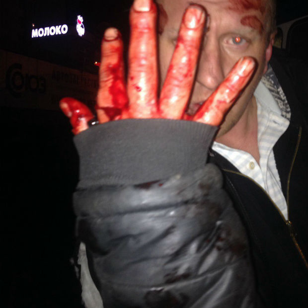 У Харкові п'яний чоловік побився з громадським транспортом (ФОТО) - фото 2