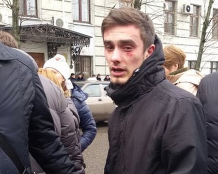 У Харкові під час мітингу за відставку Шокіна сталася бійка - фото 4
