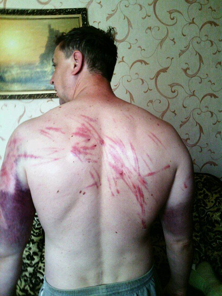 Пастор з Донецька про катування бойовиків: коли мене били, я молився (ФОТО) - фото 1