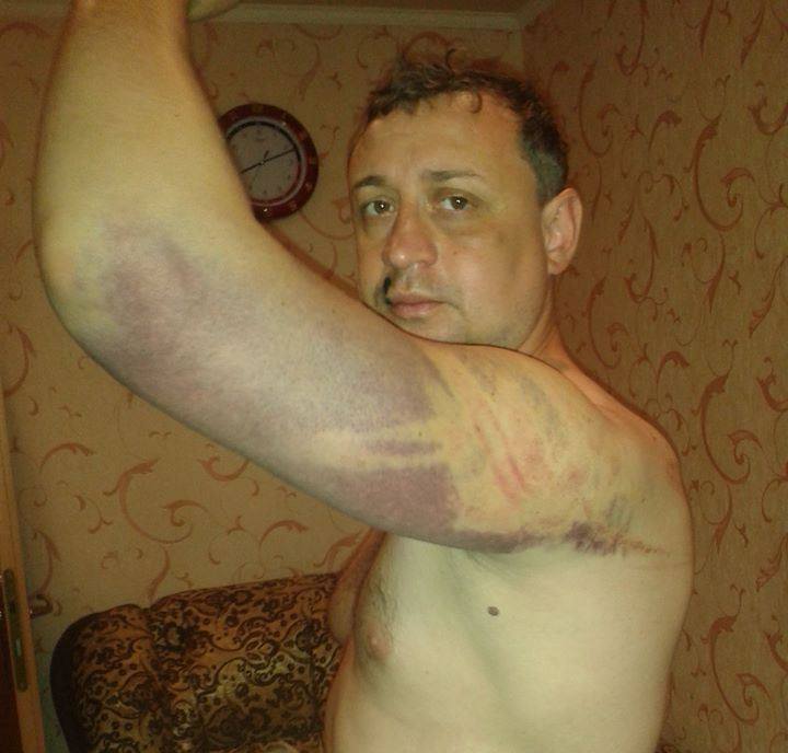 Пастор з Донецька про катування бойовиків: коли мене били, я молився (ФОТО) - фото 7