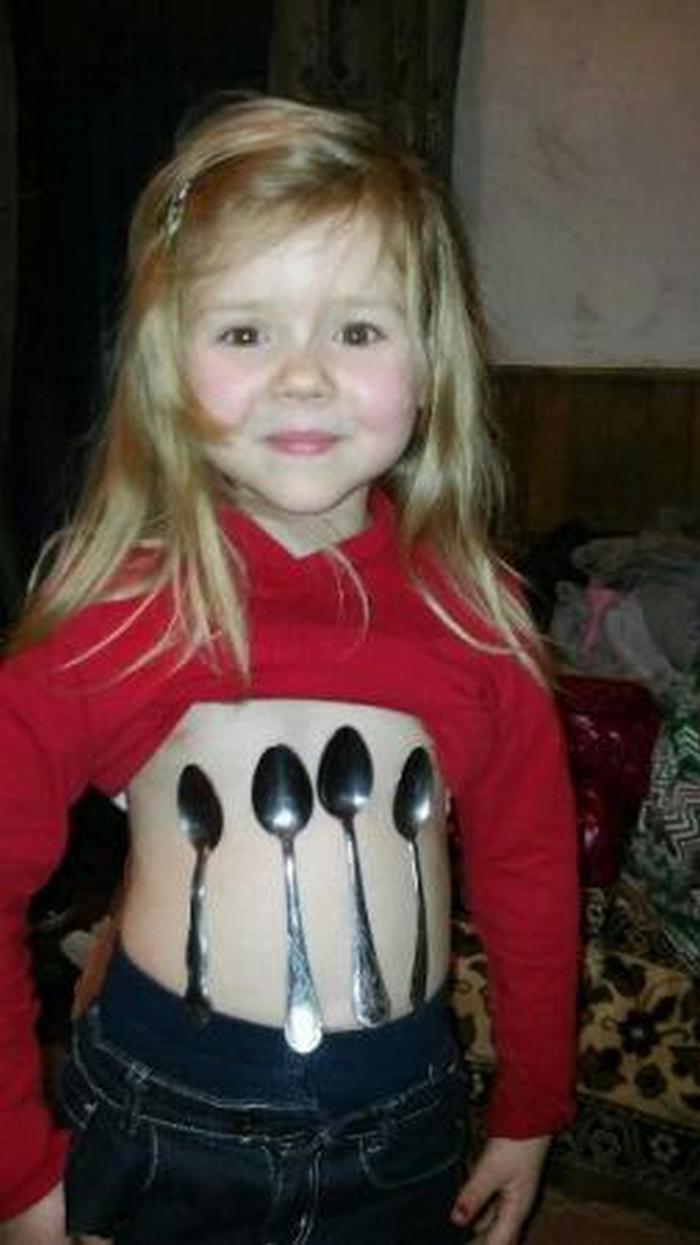 На Волині п'ятирічна дівчинка-магніт животом притягує ложки - фото 1