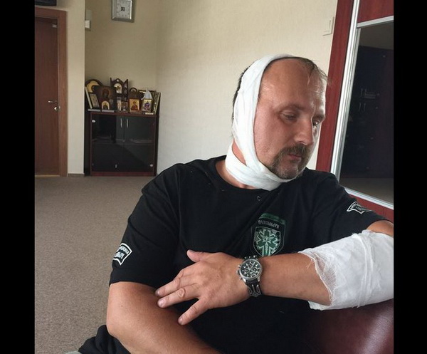 Дніпропетровський хірург був поранений на передовій, "бо не впав" - фото 1