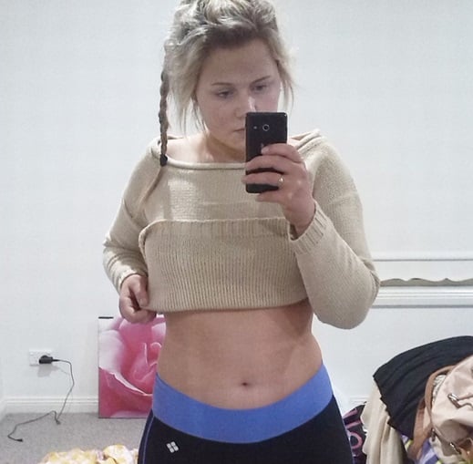 17-річна австралійка, яка схудла на 40 кілограмів, ледве вижила  - фото 1