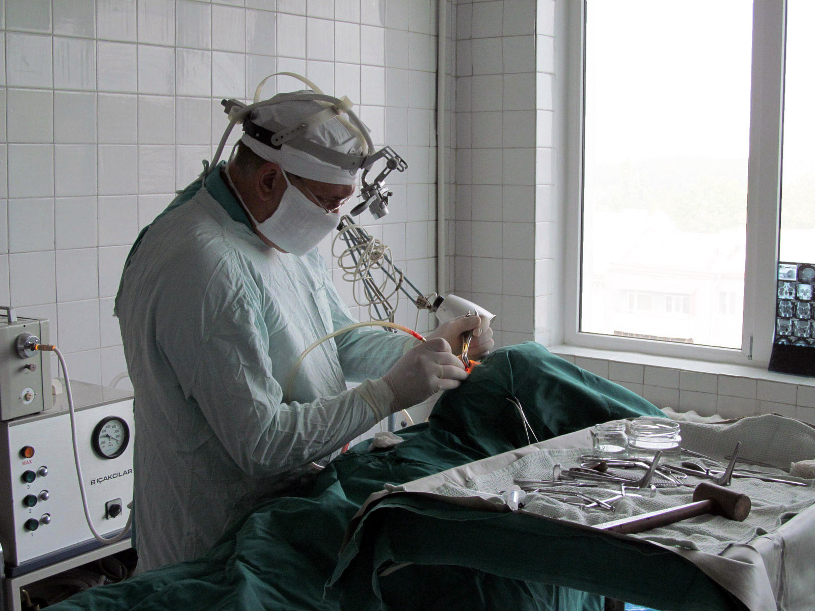 Ситуація на Донбасі: харківський госпіталь почав приймати менше пацієнтів  - фото 3
