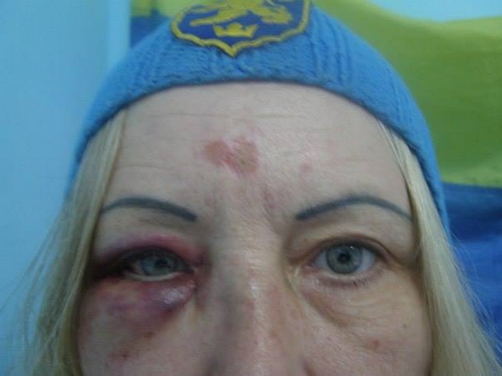 На Одещині нетверезі військові побили жінку-волонтера, яка їм допомогала - фото 1