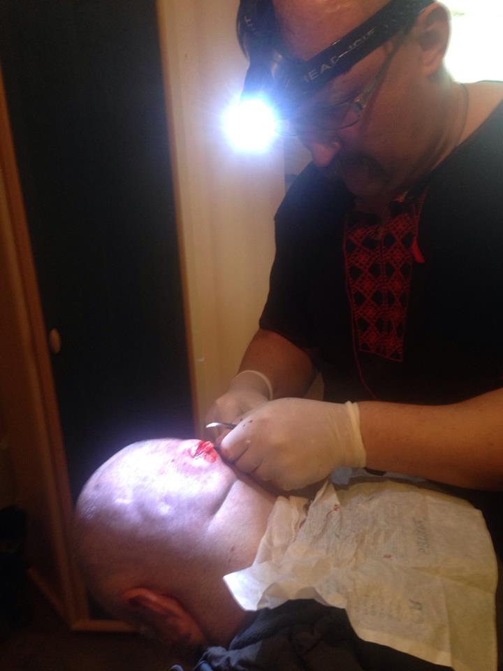 Лікар в вишиванці на передовій зробив операцію на голові бійця АТО - фото 1