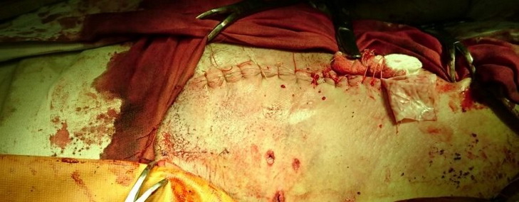 У Дніпропетровську рятують пораненого осколком в шию бійця - фото 2