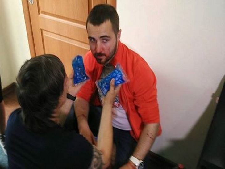 Журналістів одного з одеських телеканалів обстріляли з тавматичної зброї - фото 2