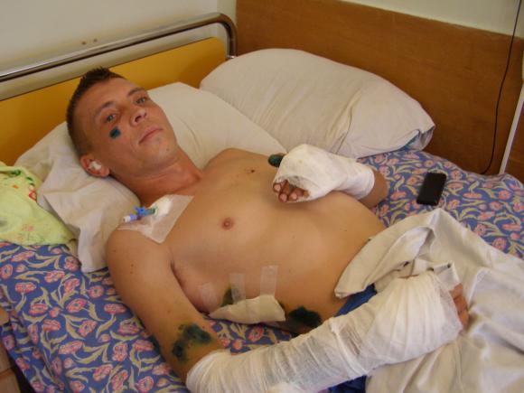 Вінницькі лікарі рятують життя ще 16 бійцям АТО  - фото 1