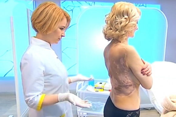 Одеський хірург провів операцію, позбавивши черкащанку 10-кілограмової родимки - фото 1