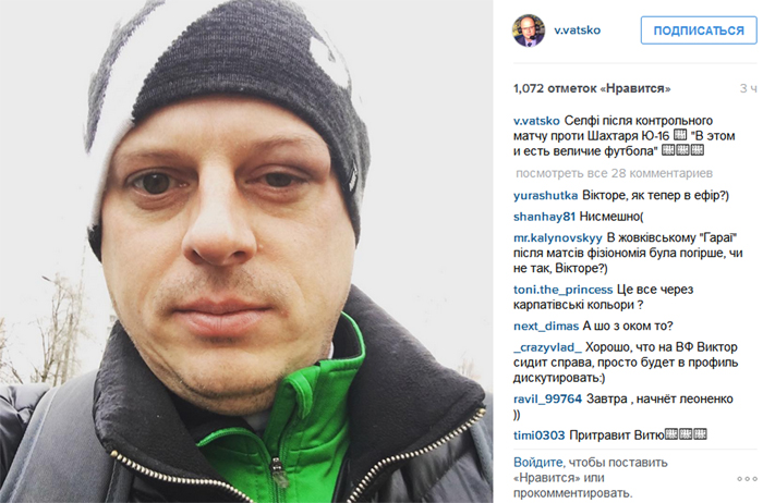 Футболісти "Шахтаря" підбили око відомому українському коментатору - фото 1