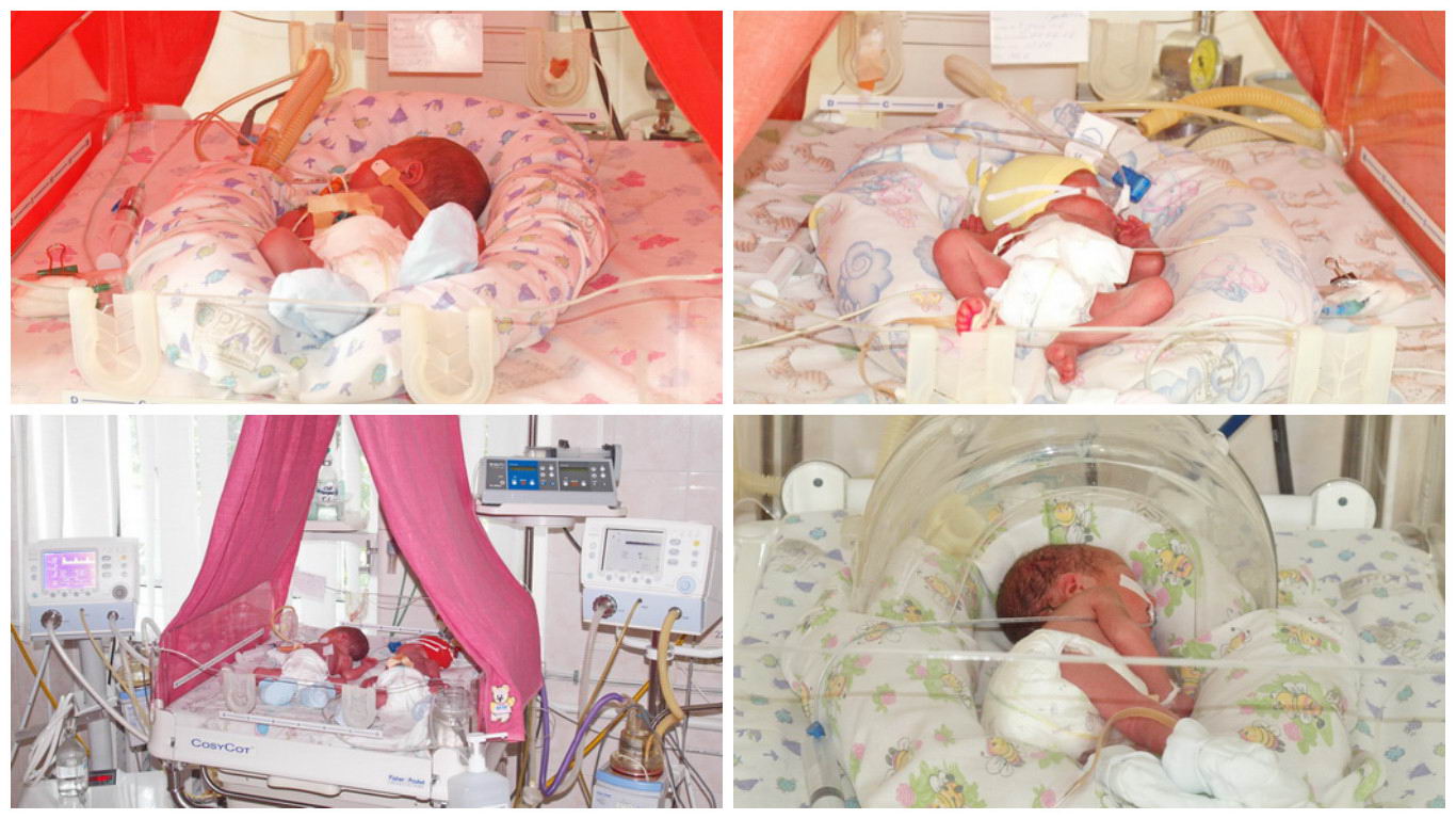 В Одесі встановлено рекорд народжуваності: на світ з'явилися відразу п'ять малюків - фото 2
