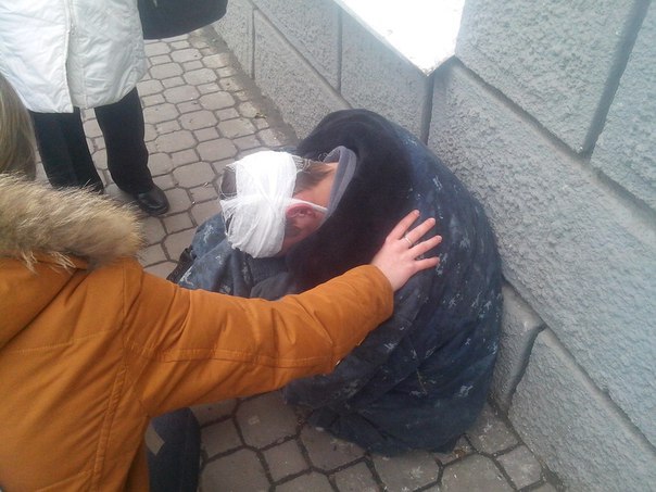У Ростові жебракує та просить милостиню закривавлений бойовик "ДНР" (ФОТО) - фото 3