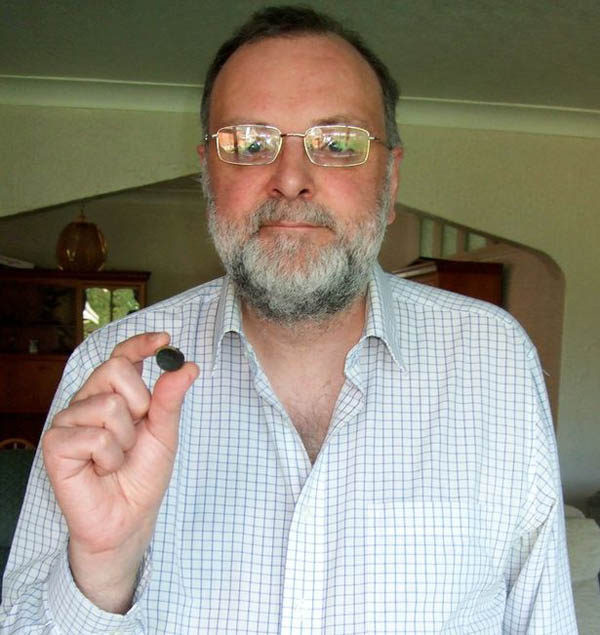 Англієць 44 роки прожив з іграшкою у носі (ФОТО) - фото 1