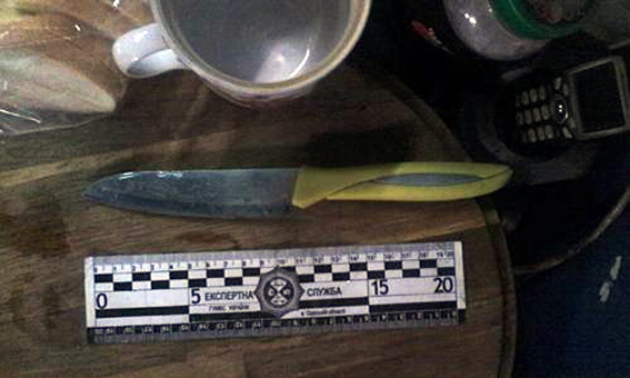 В Одесі поліція розшукує шиномонтажника, який вдарив юнака ножем - фото 1