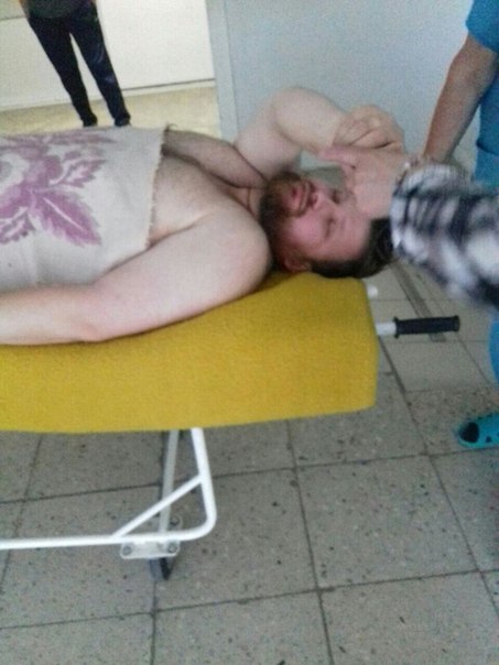 Опубліковані лікарняні фото побитого в Харкові активіста  - фото 2