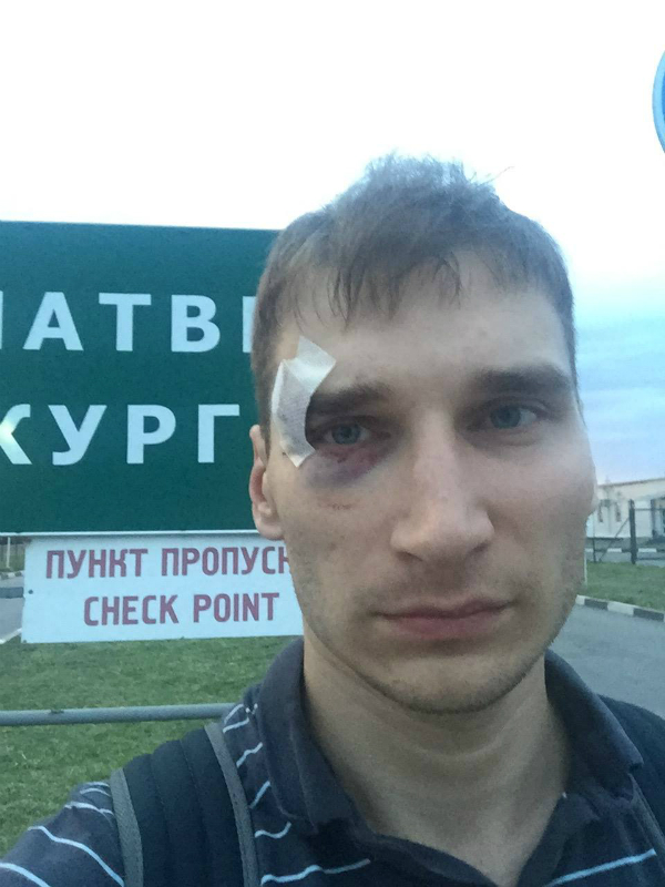 Журналіста, захопленого терористами, вивезли в Росію з підбитим оком (ФОТО) - фото 1