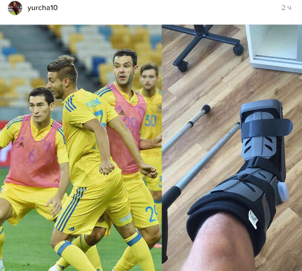 Як Юрченко з "Байера" зламав ногу на тренуванні збірної України - фото 1