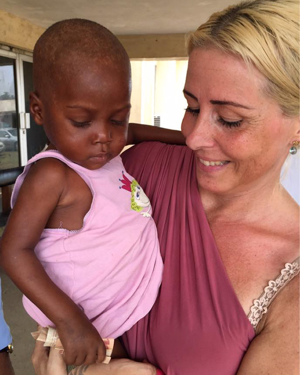 Як змінилося життя нігерійського малюка, який вмирав від дистрофії  - фото 2