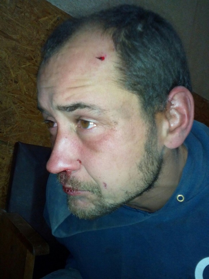 В Одесі чоловік погрожував школярам ножем, вимагаючи у них гроші (ФОТО) - фото 1