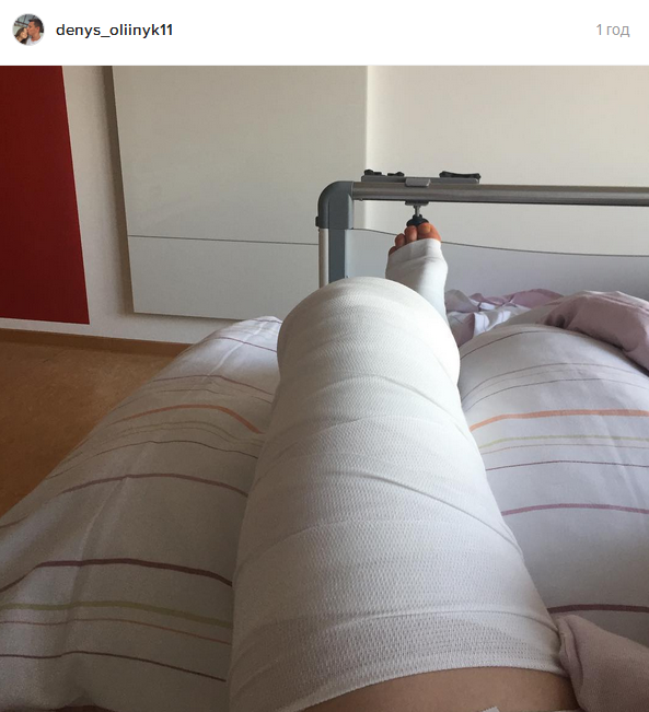 Українець з Бундесліги показав ногу після операції - фото 1