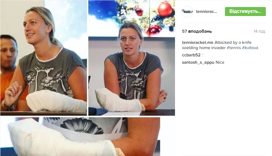 Тенісистка, яку ледь не вбили злодії, показала травмовану руку - фото 1