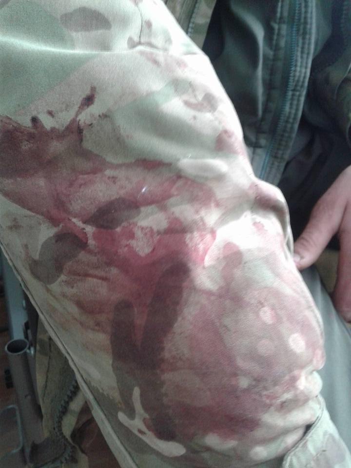 Потужний обстріл позицій ЗСУ під Маріуполем: у шпиталі багато поранених (ФОТО) - фото 2