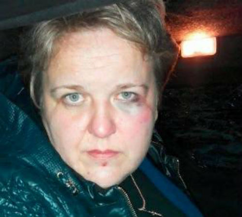На Київщині жорстоко побили активістку-дружину учасника АТО - фото 1